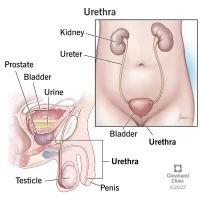 Bladder and Urethral Conditions