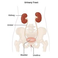 Interstitial Cystitis_Bladder Pain Syndrome
