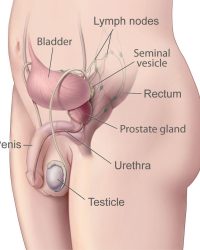 Prostate Conditions