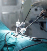 Robotic Surgery: What It Is, Examples, Benefits & Risks
