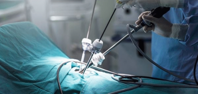 Robotic Surgery: What It Is, Examples, Benefits & Risks