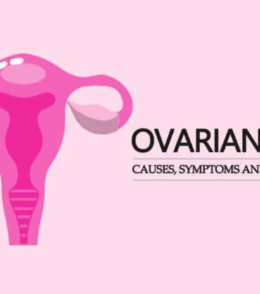 Best Ovarian Cyst Treatment in India - Surgery and Treatment | ILSS Hospital