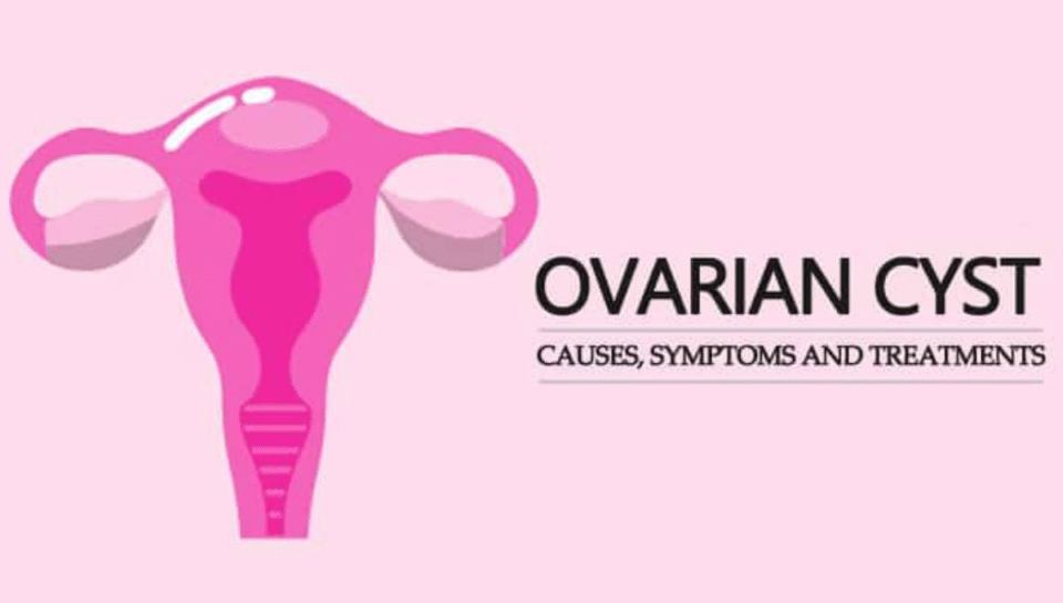 Best Ovarian Cyst Treatment in India - Surgery and Treatment | ILSS Hospital