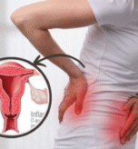 Best Uterine Fibroids Treatment in Faridabad, Delhi NCR | ILSS Hospital