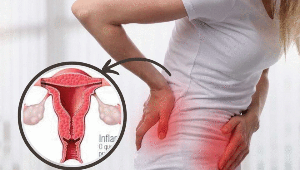 Best Uterine Fibroids Treatment in Faridabad, Delhi NCR | ILSS Hospital