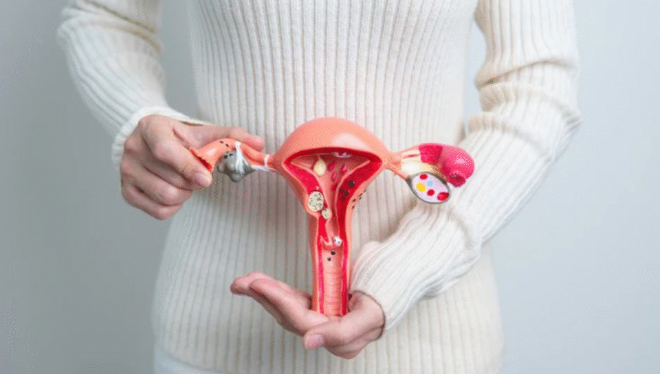 Best PCOD Treatment in Delhi | ILSS Hospital