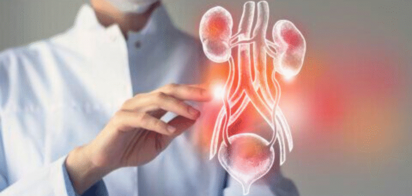 Best Prostate Cancer Treatment in Faridabad | ILSS Hospital